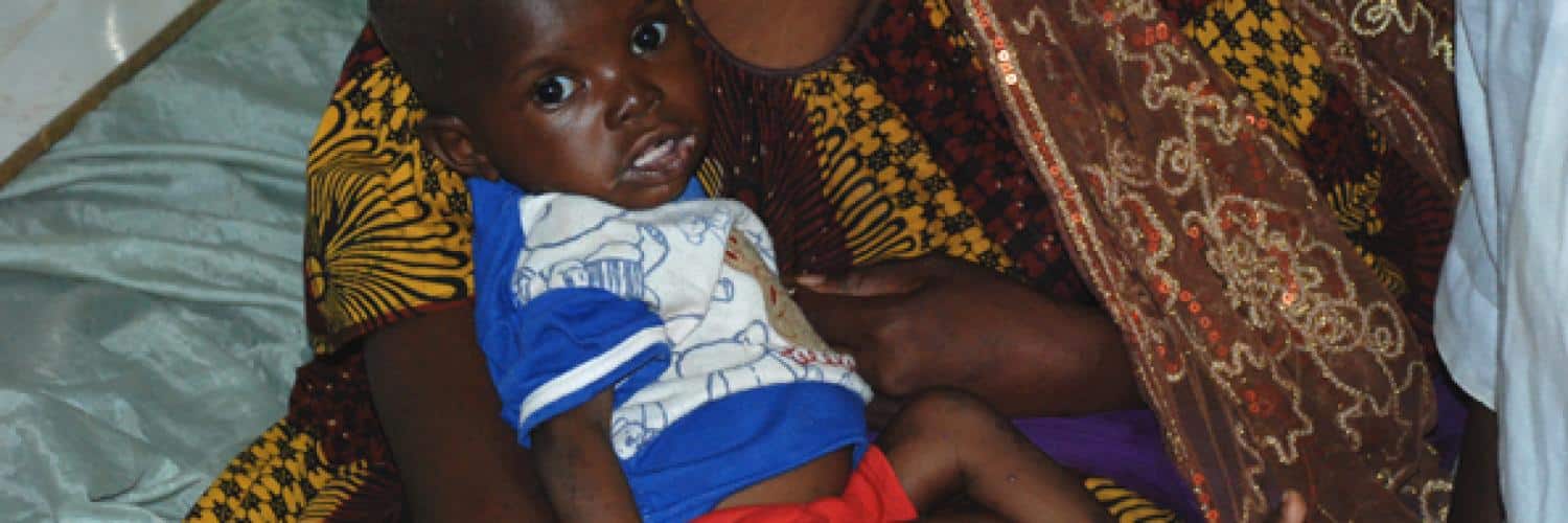 Malnutrition in Mali: causes, effects and solutions