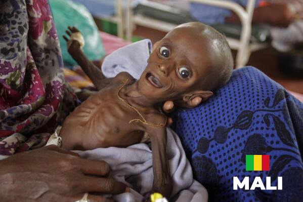 Mali’s hunger fallout: what happens next if the world looks away?